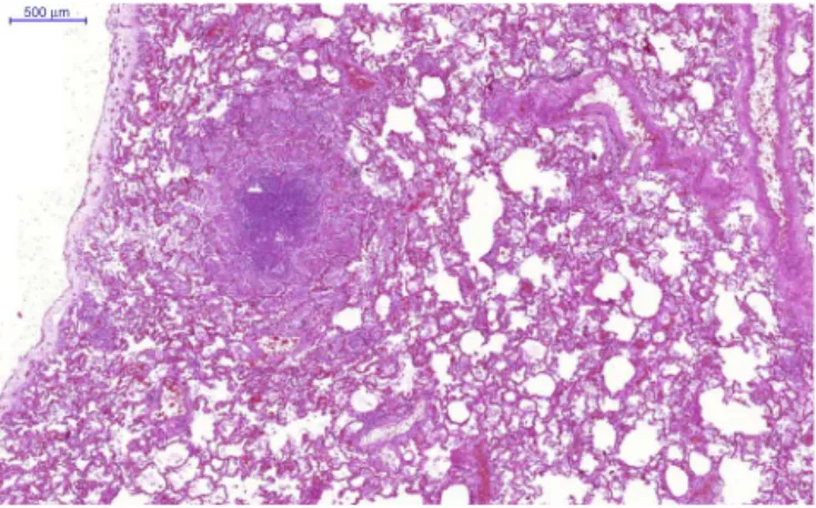 Fig. 5 – Granulomatous inflamation and caseous necrosis in lungs (case 3).