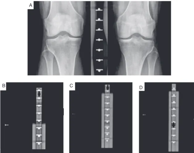 Fig. 2 – Distribution of radiopaque markers in the novel positioning device. (A) X-ray beam tangential to articular knee space at 10 ◦ caudal angulation; (B) X-ray beam 2 cm above articular knee space at 10 ◦ caudal angulation; (C) X-ray beam tangential to