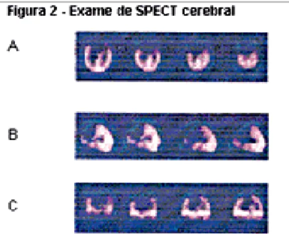 Figura 1 - Exame de ressonância magnética estrutural