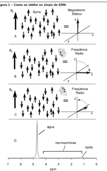 Figura 1 – Como se obtêm os sinais de ERM.