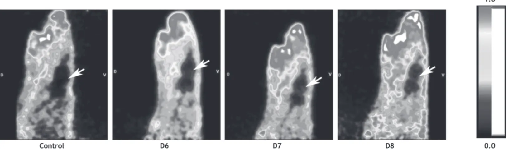 Figure 4 Sagittal view of the head of a control rat (control) and a rat infected with HSV-1 (day 6(D6); day 7 (D7) and day 8  (D8) after virus inoculation)