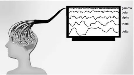 Figure 1 EEG is a non-invasive method invented by neuropsychiatrist Hans Berger (1873-1941) that records brain electrical activity