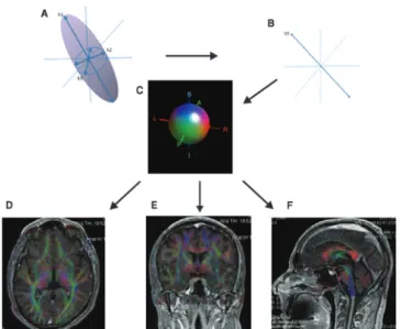 Figure 1 Diffusion measurements along multiple axes. The shape and the orientation of a diffusion ellipsoid is estimated