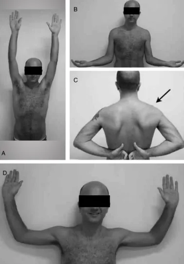 Figure 7 – Functional and cosmetic result, one year after the operation. 