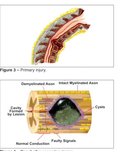 Figure 3 –  Primary injury.