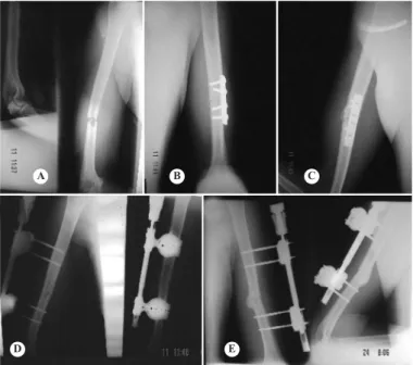 Figure 5 –  Same  patient  as  in  Figure  1,  after  two  years  of  treatment in different clinics
