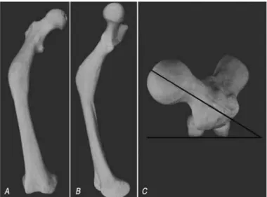 Figure 1- plastic bone imitating an angular deformity (A: varus; 