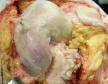 Figure 2 –  Preoperative view of the left knee.