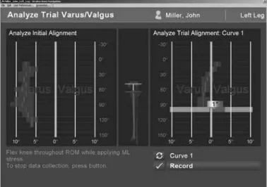 Figure 6 – Navigation screen comparing the limb alignment rela- rela-tive to the mechanical axis, along the entire arc of movement
