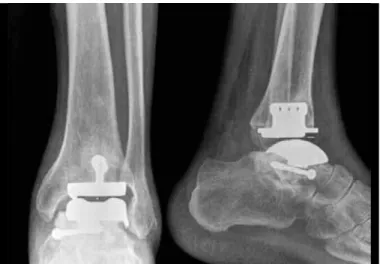 Figure 3 – Radiographs after 12 months of follow-up.