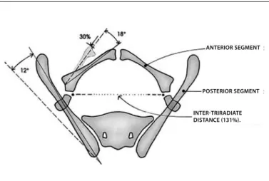 Figure 1 – Pelvic anatomy in cases of bladder exstrophy.