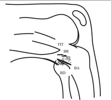 Figure 2 – Anteroposterior and lateral X-ray, without bone changes, of the  knee affected by subluxation of the biceps femoris tendon.