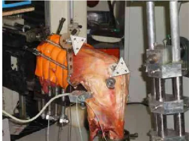 Figure 4 – Graft fixation system with cannulated screw and load cell. In 