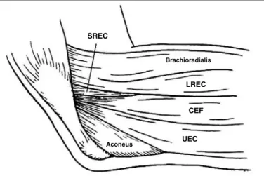 Figure 1 –  Drawing of the anatomy of the lateral face of the elbow. The SREC is located  below the common extensor of the fingers and the LREC.