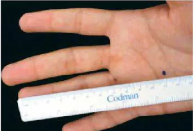 Figure 4 – Parameters for determining the ideal diameter for a tennis racket handle.