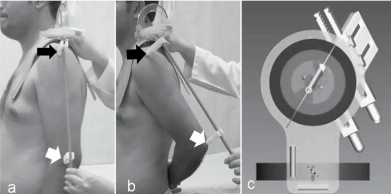Figure 2 – Positioning of the bi-goniometer on the shoulder, with patient standing upright