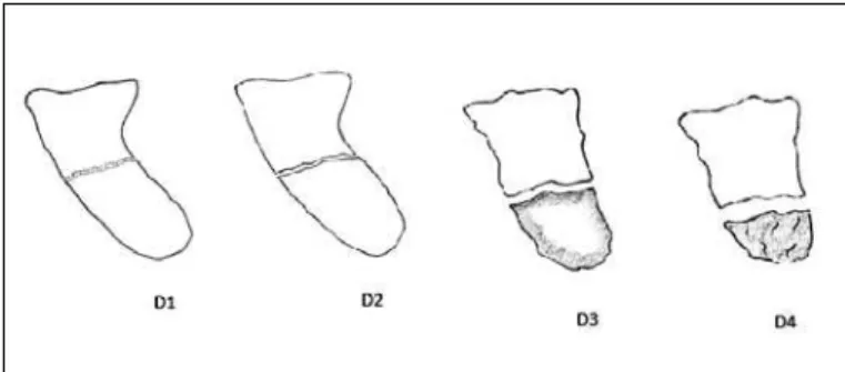 Figure 1 – Filan and Herbert classification (12) .