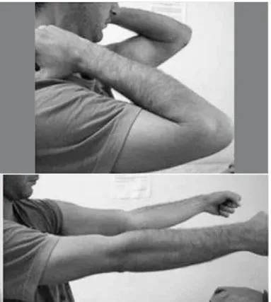 Figure 2 – Patient three months after the operation, showing range  of motion of 140° for elbow flexion.
