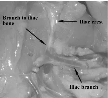 Figure 3 – Ligation of the iliac branch distally to the emergence of  the vessel to the iliac bone