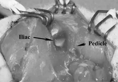 Figure 5 – Exposure of the external face of the iliac bone after  incision and separation of the gluteal muscle.
