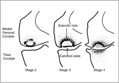 Figure 1 – Koshino classification.