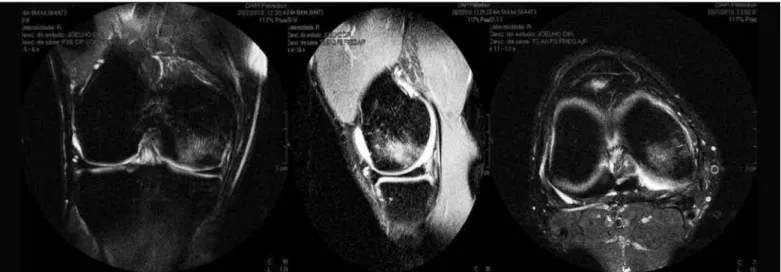 Figure 3 – MRI on July 20, 2010 (second control).