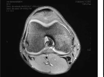 Figure 5 – MRI on September 16, 2010.