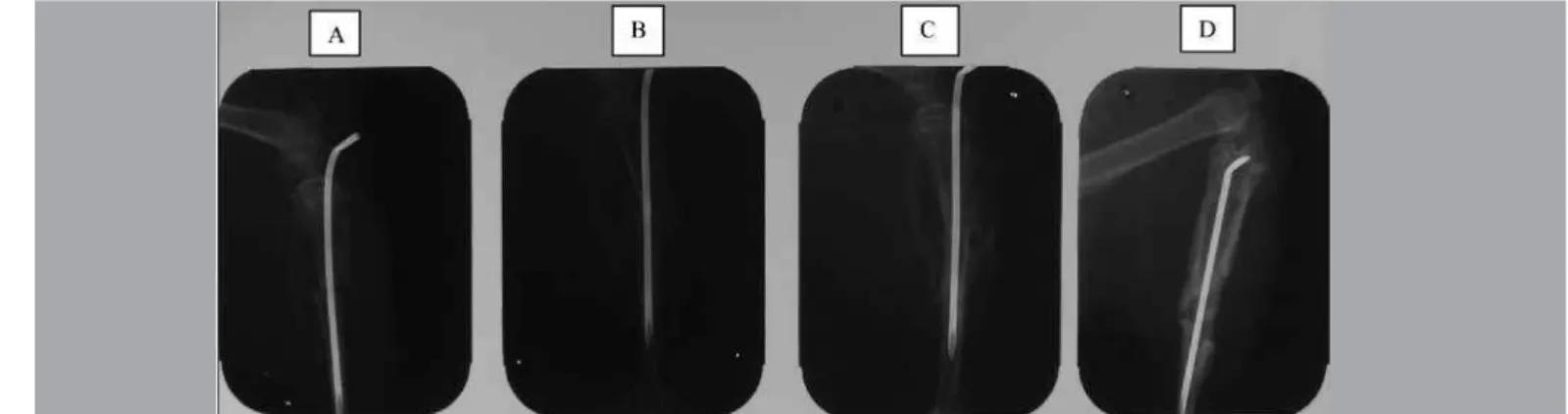 Figure 4 –  Lateral-view radiographs on experimental group II (EG II): (A) just after fracturing; (B) on 15th day; (C) on 30th day; and (d) on 45th day