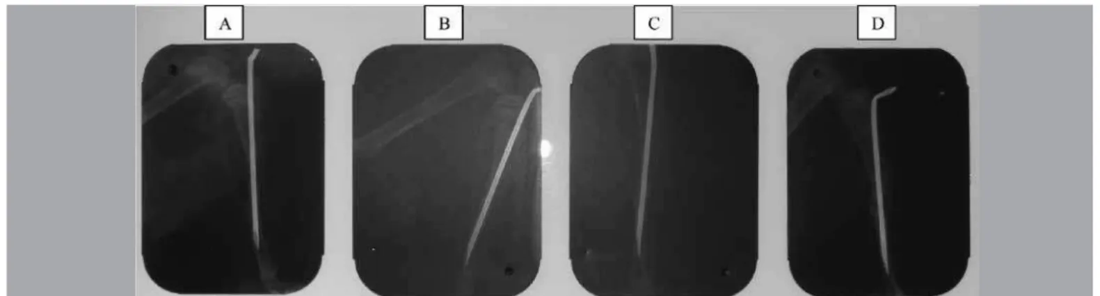 Figure 5 –  Lateral-view radiographs on experimental group III (EG III): (A) just after fracturing; (B) on 15th day; (C) on 30th day; and (d) on 45th  day