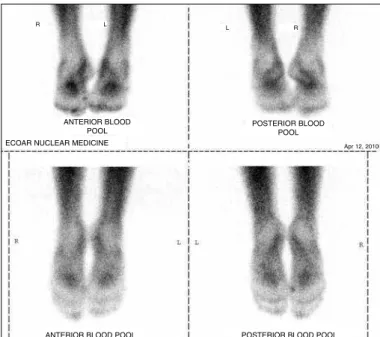 Figure 2 – Images at equilibrium (vascular permeability) with the feet in  anterior, posterior and plantar projections of the medial sesamoid of the  right metatarsal.