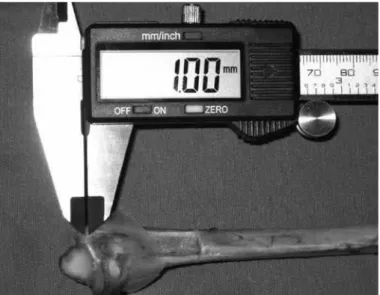 Figure 3 – Joint step of 1 mm, measured using digital calipers,  and bone fragment fixed with colorless adhesive tape.