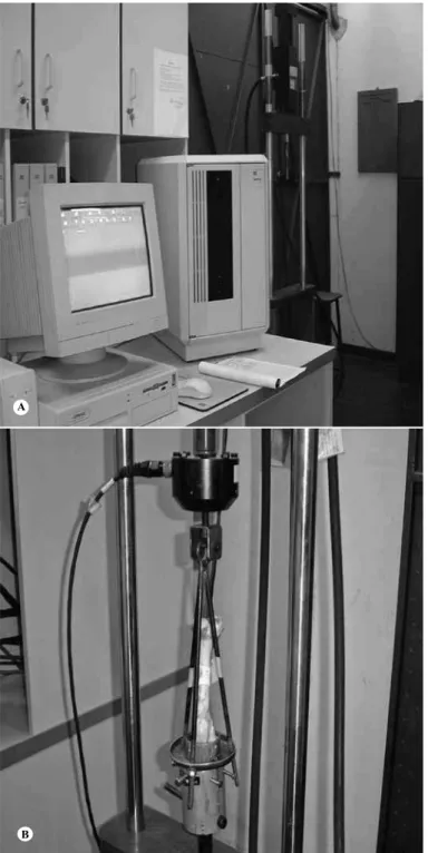 Figure 6 – Graph comparing the maximum load values between  the different fixation groups: interference screw, fixation to cortical  bone and fixation to spongy bone.