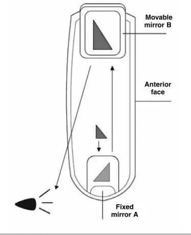 Figure 3 - Lateral view of an L-shaped rotator cuff lesion,  with suture threads fixed to the humeral neck by means of a  metal anchor.