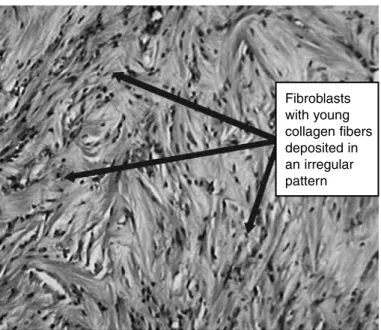 Figure 10 -  Tsai technique (6-strand) on the 30 th  day, showing the  positions of the mature collagen fibers: aligned with the tendon  axis, i.e