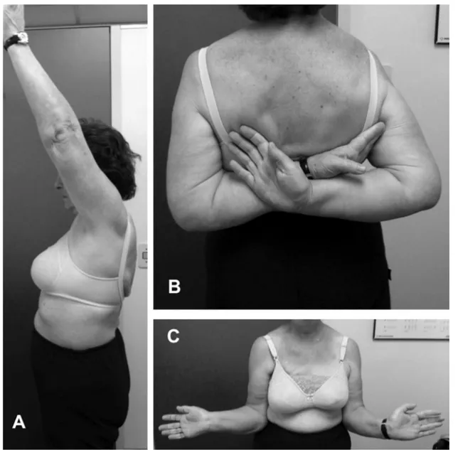 Fig. 6 – Functional evaluation on a patient 12 months after the operation. (A) Elevation; (B) internal rotation; (C) external rotation.
