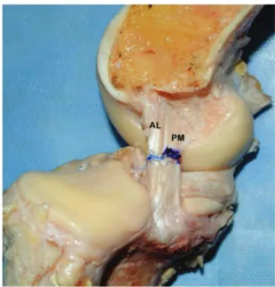 Fig. 2 - Macroscopic aspect of the tibial insertion areas  of the anterolateral (a) and posteromedial (b) bundles  of the posterior cruciate ligament in the posterior tibial  intercondylar area of a right knee and the reference marker