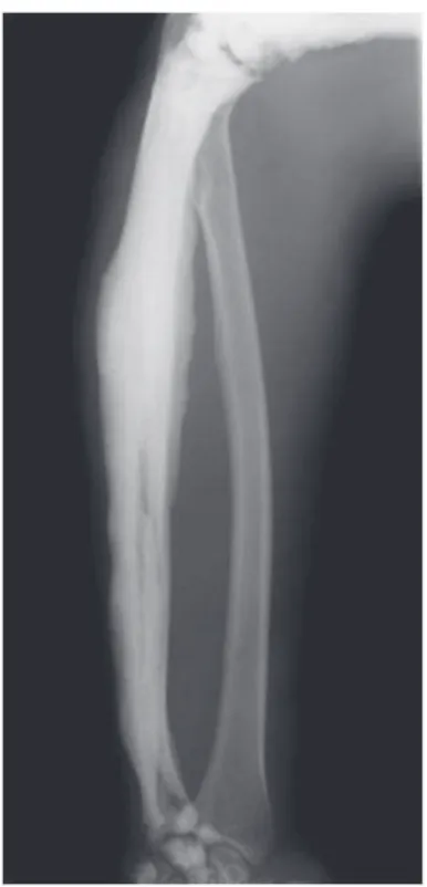 Fig. 2 - Forearm X-ray.