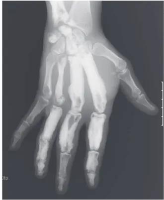 Fig. 5 - Foot X-ray.