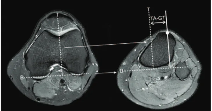 Table 1 - Prevalence of the findings from MRI.