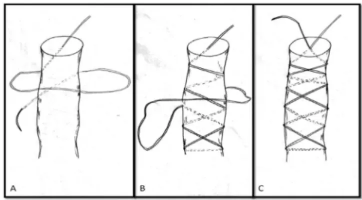 Fig. 1 - (A) Start of preparation of stitches in “X” 
