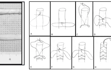 Fig.  3 - (A) Synthetic polyester No. 5 braided thread on  needle. (B) Needle separated from the thread