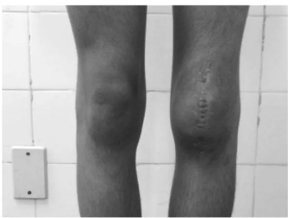 Fig. 5 - Functional evaluation of the left knee.