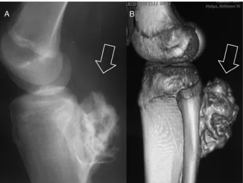 Fig. 2 – The long bones of the lower limbs (knee region) are most commonly affected. (A) Simple lateral radiograph