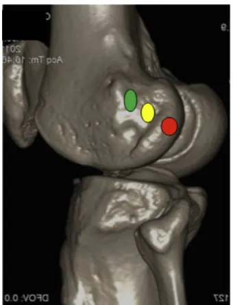 Fig. 1 – Tomographic image of the knee with 3D