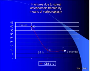 Fig. 5 – Decrease of the ODI score from 40% to 10%, 24 h after vertebroplasty, and its maintenance at 9%, six months after the procedure.