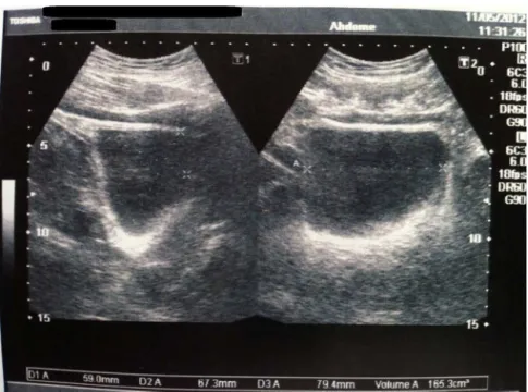 Fig. 7 – Postoperative control echographs of the urinary tract and prostate, within normal patterns.