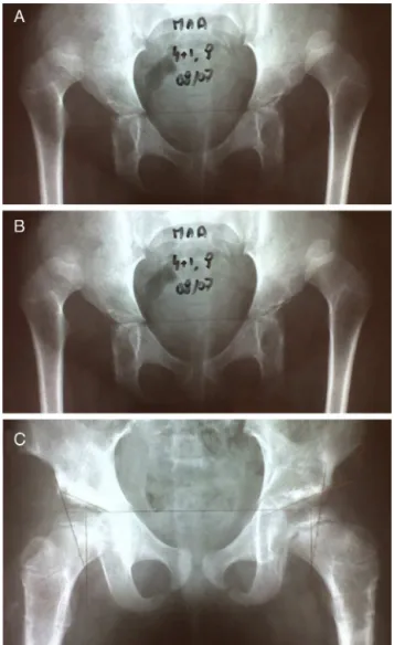 Fig. 2 – Female patient aged three years and three months: