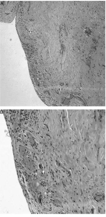 Fig. 1 – Normal trochanteric bursa stained using the hematoxylin-eosin technique: (A) magnification of 100×