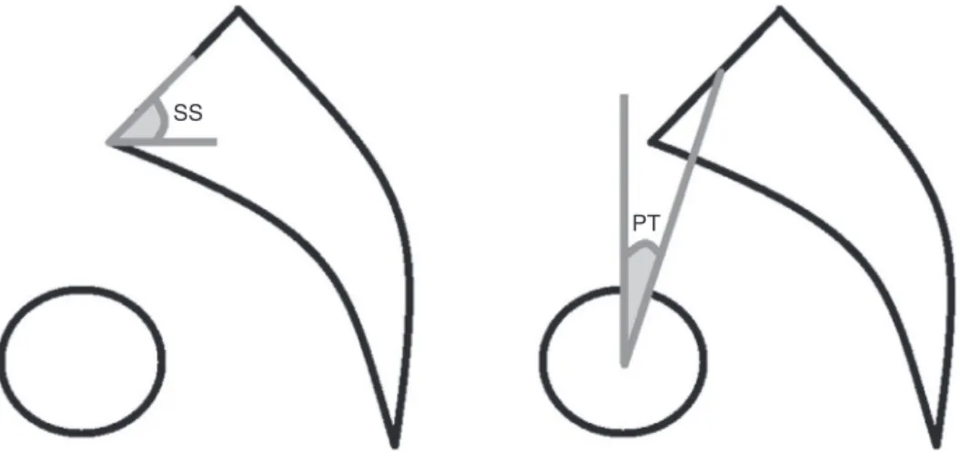 Fig. 2 – Illustration of sacral slope (SS) and pelvic tilt (PT).