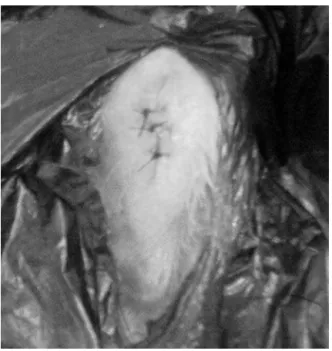 Fig. 1 – Photo of the skin incision and ACL capsulotomy.